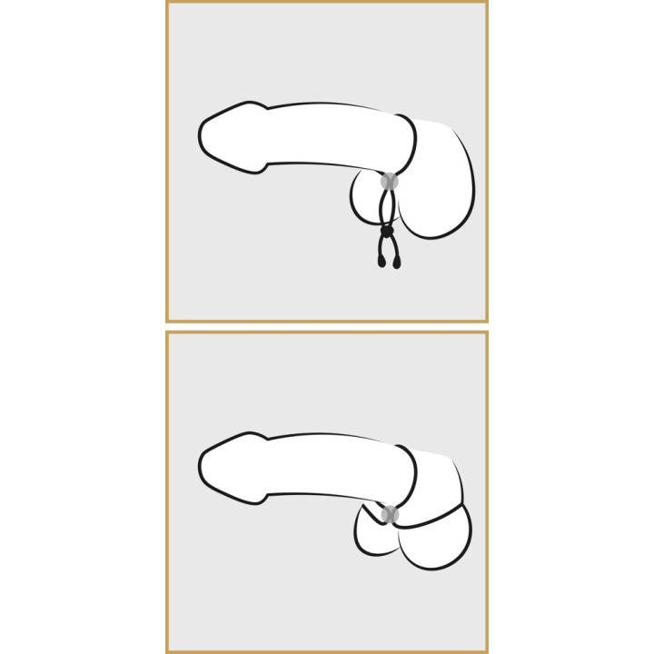 BK cock & ball loop